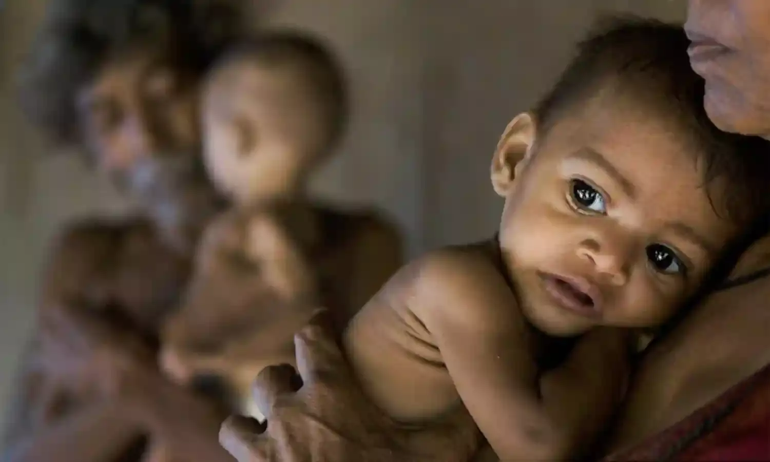 छह से 23 महीने की उम्र के 10 भारतीय शिशुओं में से एक को मिलता है पर्याप्त आहार