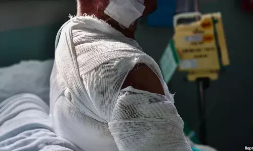 हॉस्पिटल बेड, प्रशिक्षित स्टाफ़ और आंकड़ों की कमी से जूझ रहा है भारत का बर्न केयर मैनेजमेंट