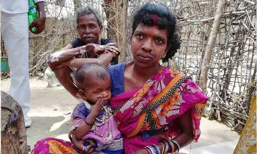 राष्ट्रीय पोषण मिशन से देश को क्रांति की उम्मीद ! राष्ट्रीय पोषण मिशन से देश को क्रांति की उम्मीद !