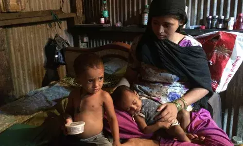 मुंबई के एम ईस्ट में 2 साल तक के 50 फीसदी बच्चे स्टंड,  40 फीसदी कम वजन के मुंबई के एम ईस्ट में 2 साल तक के 50 फीसदी बच्चे स्टंड,  40 फीसदी कम वजन के