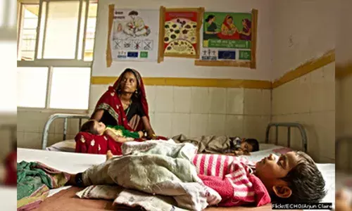 कम हो रहा है कुपोषण लेकिन अल्पपोषितों की संख्या है अधिक कम हो रहा है कुपोषण लेकिन अल्पपोषितों की संख्या है अधिक