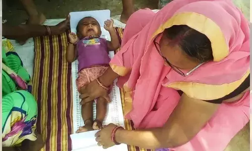 पोषण माह के दौरान यूपी में मिले 15 लाख से अधिक नए कुपोषित बच्चे पोषण माह के दौरान यूपी में मिले 15 लाख से अधिक नए कुपोषित बच्चे